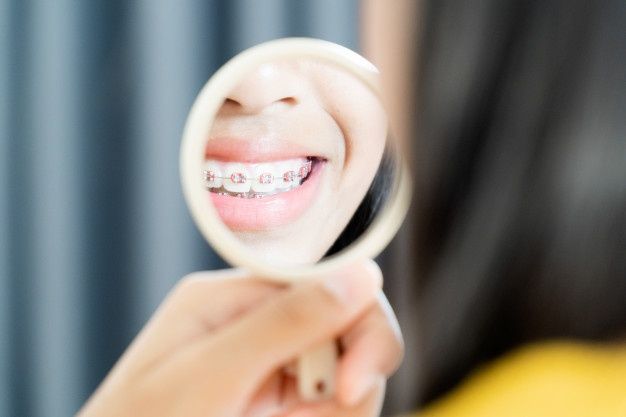 Tratamiento de ortodoncia con brackets